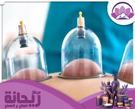 مركز حجامة القطيف