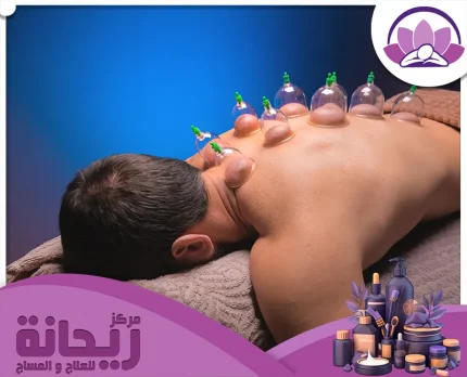 مركز حجامة الدمام