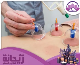 مركز حجامة الجبيل