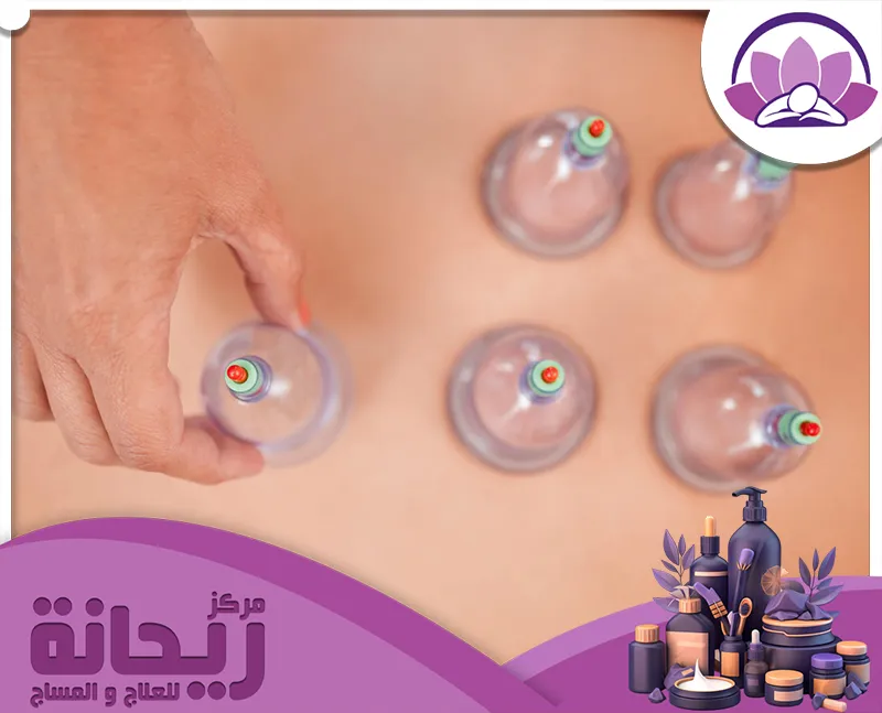 مركز حجامة في الخبر 594720606 مركز الريحانة يقوم متخصص مركز الريحانة بعمل الحجامة بدقة عالية لتحفيز الدورة الدموية وتخفيف الألم.
