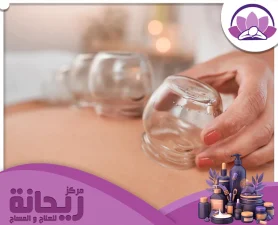 مركز حجامة الخبر